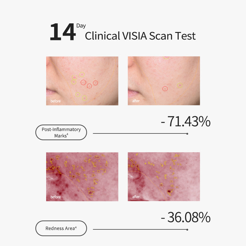 Tranexamic Acid Refreshing Serum