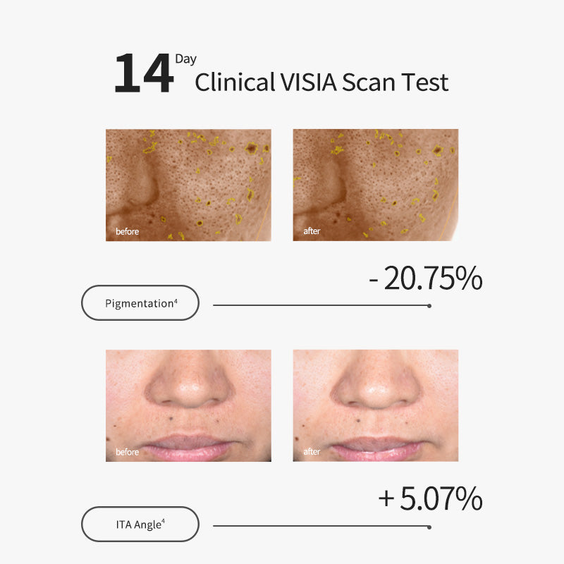 Tranexamic Acid Refreshing Serum