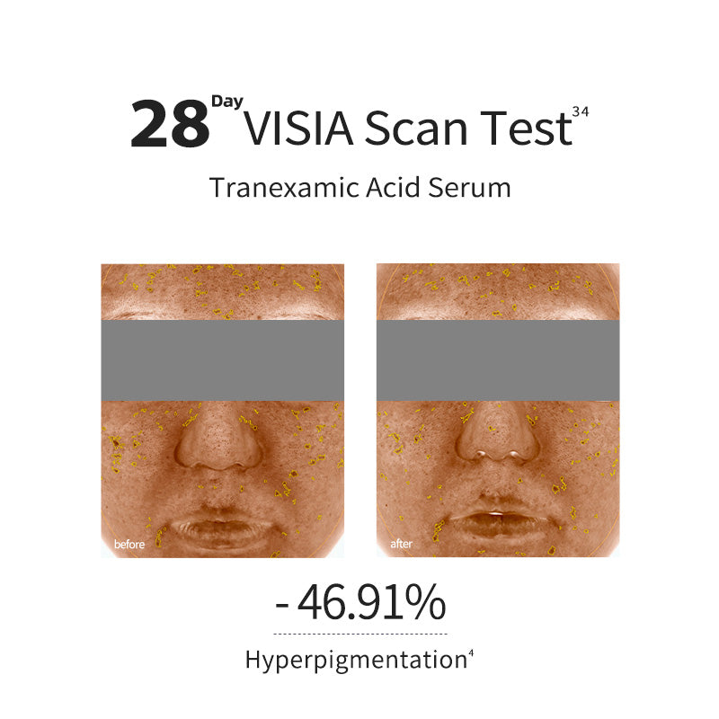 Skin Purifying Moist Serum