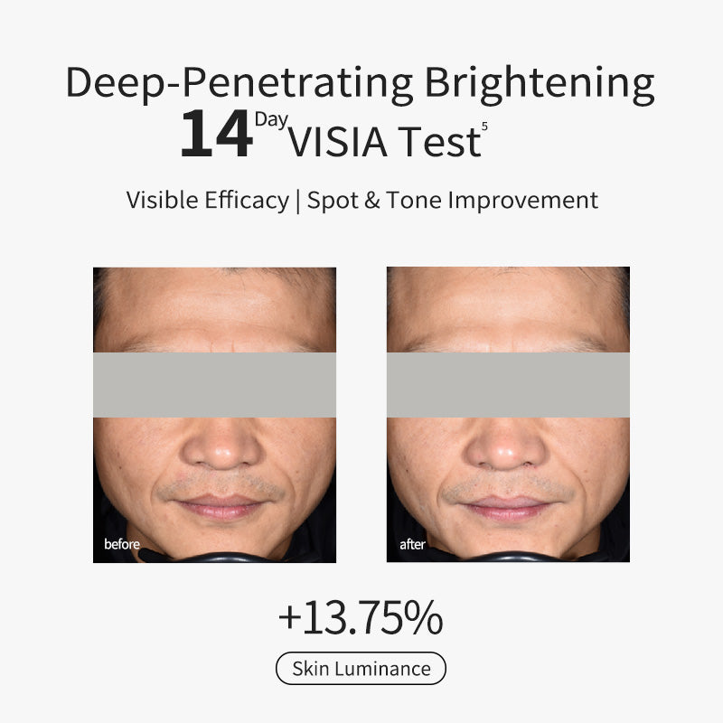 Whitening & Spotclear Essence Cream