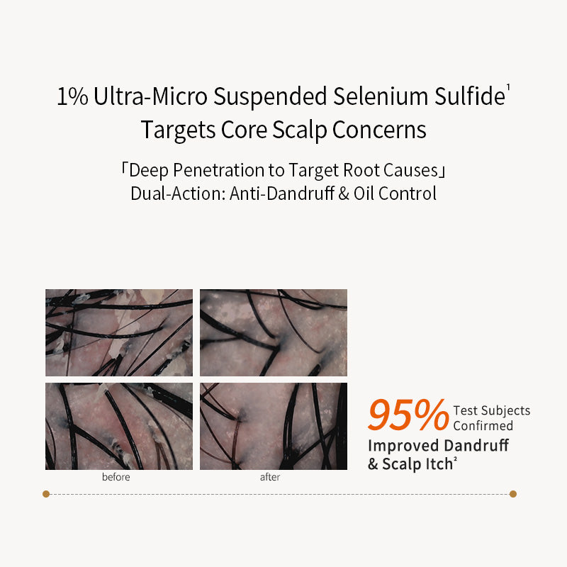 Selenium Sulfide Anti-dandruff & Anti-Itch Shampoo