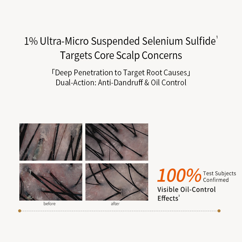 Selenium Sulfide Anti-dandruff & Anti-Itch Shampoo