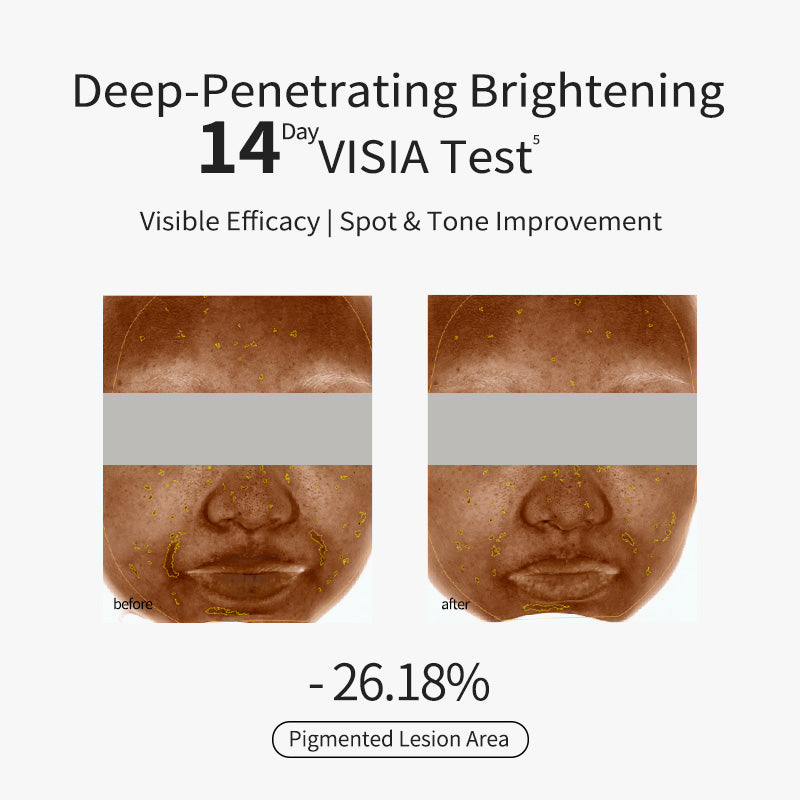 Whitening & Spotclear Essence Cream