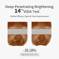 Whitening & Spotclear Essence Cream
